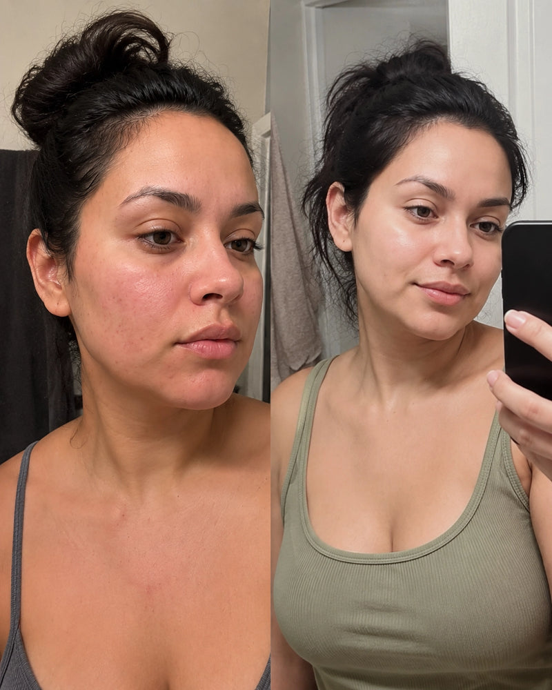 My skin looks calmer and more even